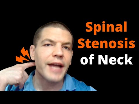 Spinal Stenosis Of Neck Symptoms (Cervical Spinal Stenosis)