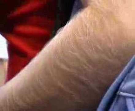 Hairy Arms Flickr