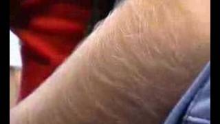 Hairy Arms