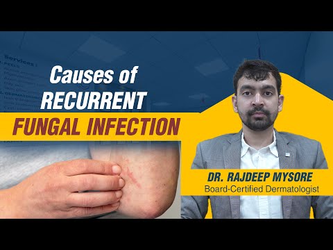 Common Causes of Recurrent Fungal Infection - Dr. Rajdeep Mysore | Charma Clinic