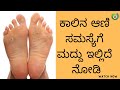 ಕಾಲಿನಲ್ಲಿ ಆಣಿ ಆಗಿದ್ದಲ್ಲಿ ಹೀಗೆ ಮಾಡಿ ಆ�