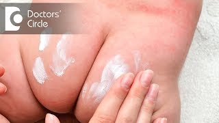 How to manage rashes on buttocks? - Dr. Rasya Dixit
