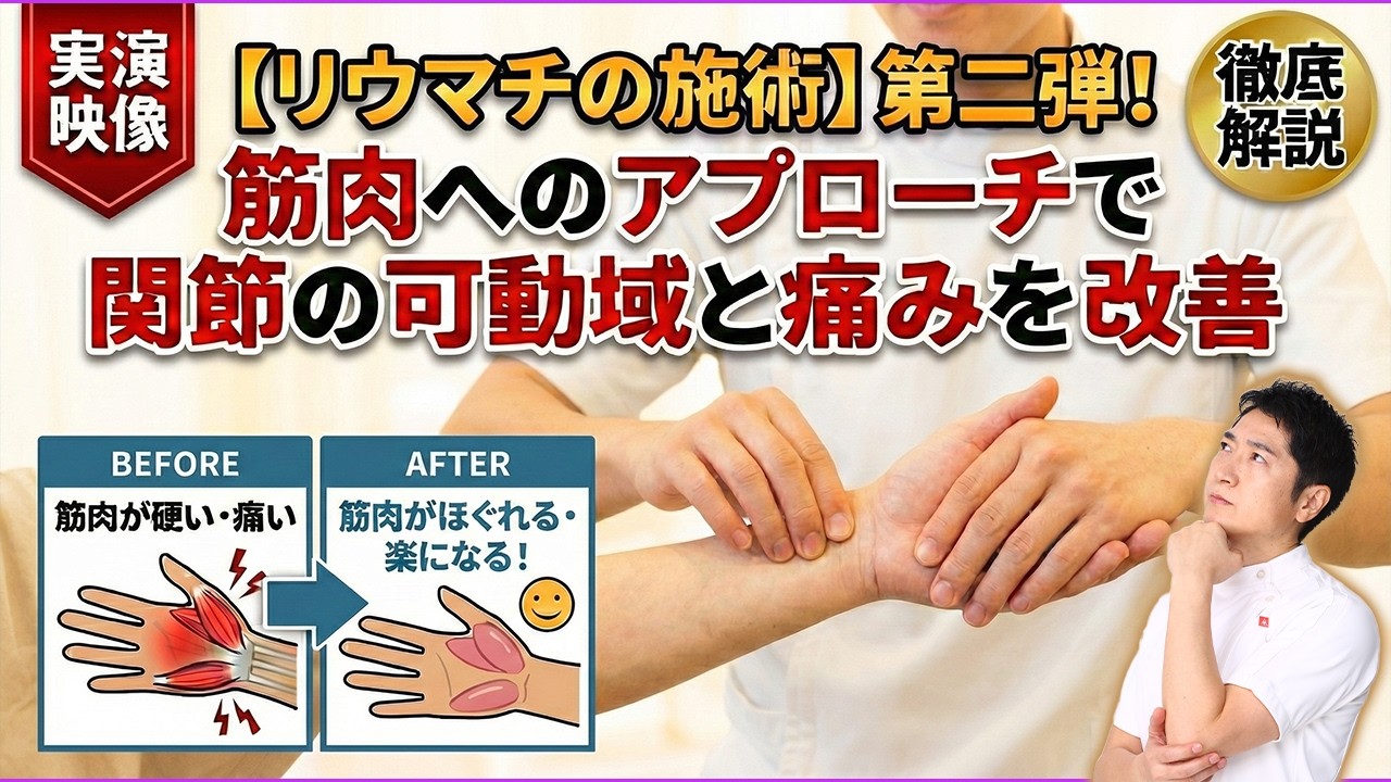 【第2弾】リウマチ患者さんの、筋肉へのアプローチで関節の可動域と痛みを改善する方法を！