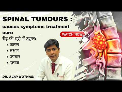 Spinal tumours :causes symptoms treatment cure रीढ़ की हड्डी में ट्यूमर: कारण,लक्षण,उपचार,इलाज #pune| Dr Ajay Kothari