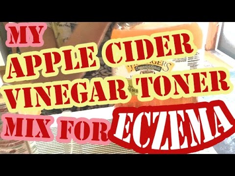 Organic Apple Cider Vinegar and Witch Hazel Toner Mix