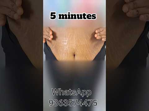 Belly fat oil massage step by step || burn belly fat in just 5-7 days #shorts #bellyfat