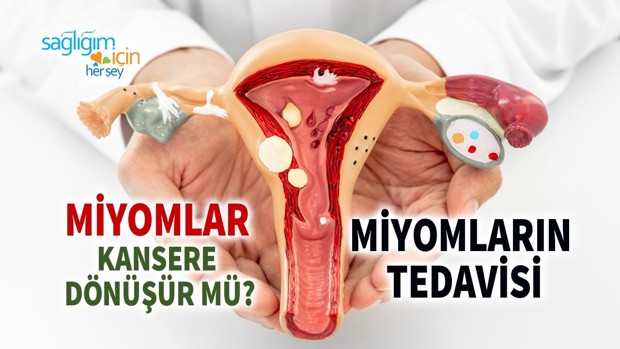 Her Miyom Gebe Kalmayı Etkiler mi?