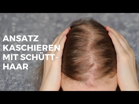 How to conceal the hairline with hair fibers | Lucky strands