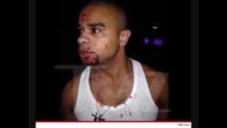 Raz B Life Is In Danger!