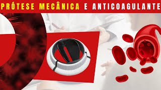 POR QUE PACIENTES COM PRÓTESE MECÂNICA PRECISAM DE ANTICOAGULANTE? Entenda a importância