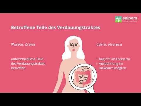 Morbus Crohn und Colitis ulcerosa - Verdauungstrakt (Mediziner erklärt)