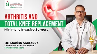 Patient Success Story: التهاب المفاصل | استبدال مفصل الركبة بالكامل | جراحة طفيفة التوغل - Video Thumbnail