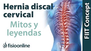 Hernia discal cervical. Desmontando mitos, leyendas y otras prohibiciones.