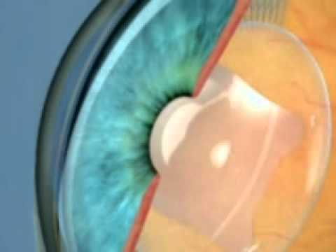 Maschera su occhi la camera dei bambini di una fotografia Affronti il pacco con olio di ricino di vaselina