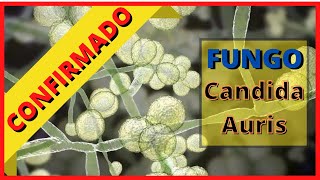 ANVISA confirma novo caso do fungo CANDIDA AURIS
