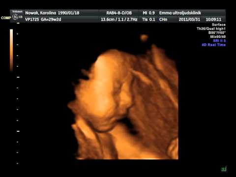 Leia Nowak i graviditetsvecka 30 - Del. II