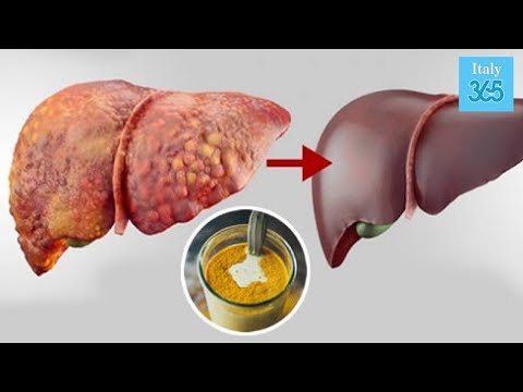 Dolori alle articolazioni del ginocchio e fare clic Set video di esercizi per malattia degenerativa del disco