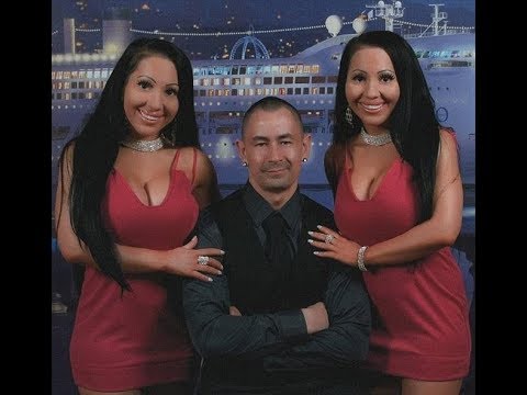 Të “mbytyra” në operacione plastike, këto dy binjake kanë të njëjtin të dashur