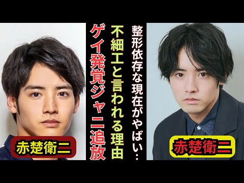 赤楚衛二、同性愛公表の真実…ジャニーズ追放の難病アイドルが不細工と言われる整形末路に絶句!