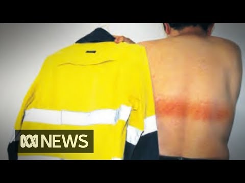 Engineer suffers first-degree burns from high-vis shirt | ABC News
