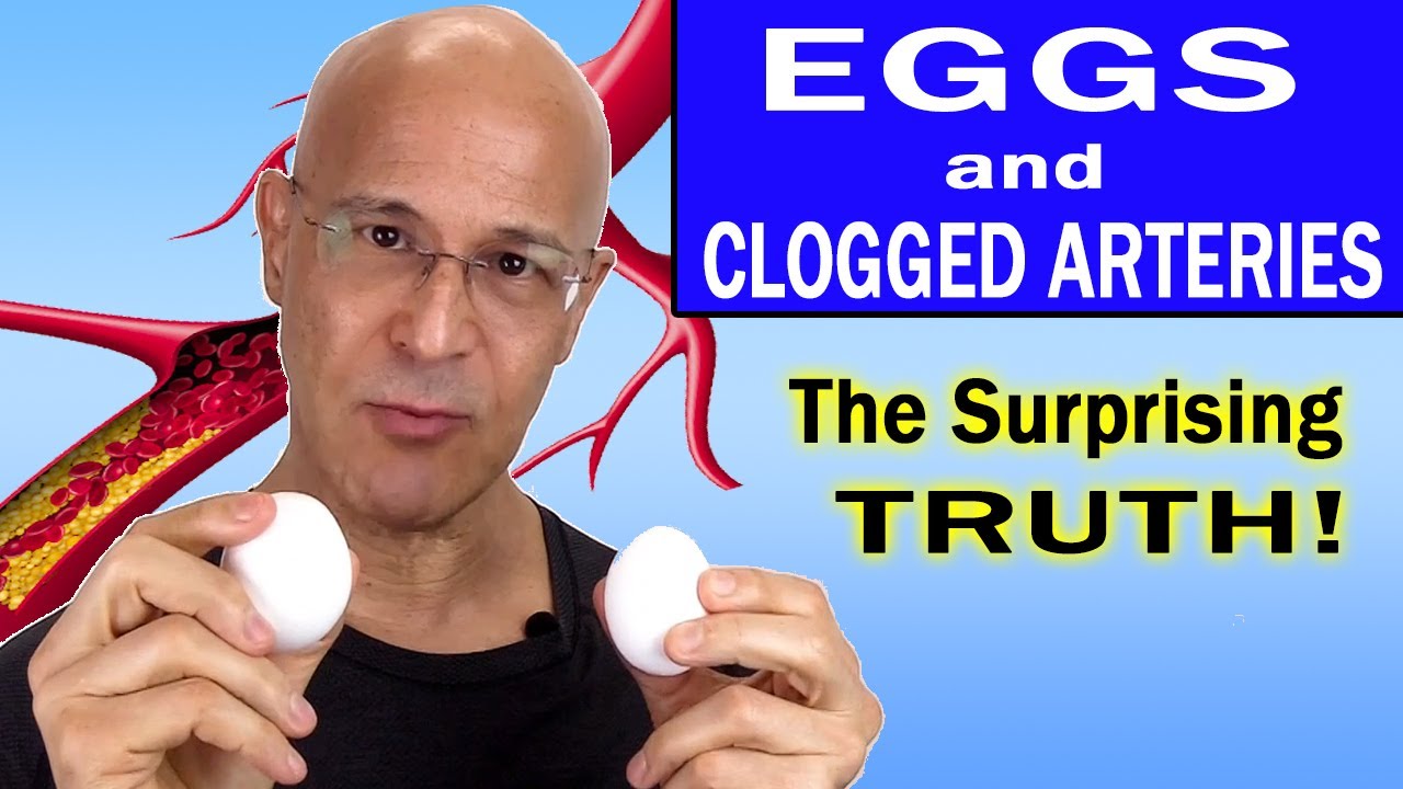 The Surprising Truth About Eggs and Clogged Arteries:  What You Need to Know!   Dr. Mandell