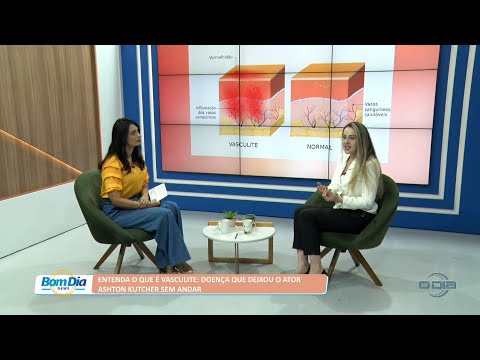 Entenda o que é vasculite: Doença que deixou o ator Ashton Kutcher sem andar 18 08 2022
