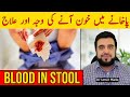 Pakhane Me Khoon Aane Ki Wajah Pakhane Me Khoon Ana Ka Ilaj Blood In Stool Rectal Bleeding Urdu