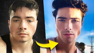 How I Debloated My Face &amp; Got Hollow Cheeks