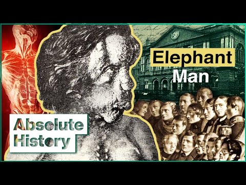 The Elephant Man: Victorian Era's Most Tragic Figure | Hidden History of Britain | Absolute History