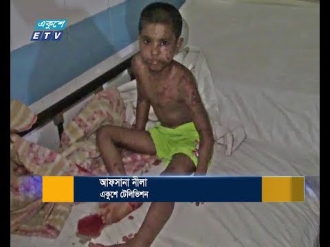 গৃহকর্ত্রীর বিরুদ্ধে গৃহকর্মীকে নির্যাতনের অভিযোগ