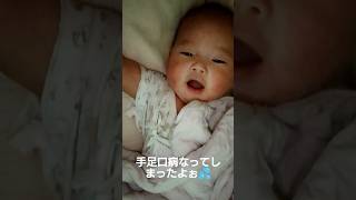生後3ヶ月で手足口病なってしまった😭