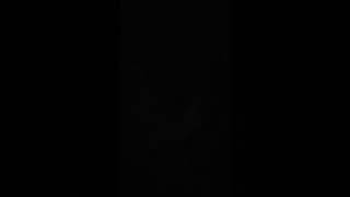 Help ! I was yanked to the ground and dragged by my arm