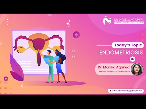 Endometriosis - Dr. Monika Agarwal