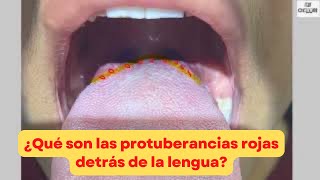 ¿Qué son las protuberancias rojas detrás de la lengua   papilas gustativas
