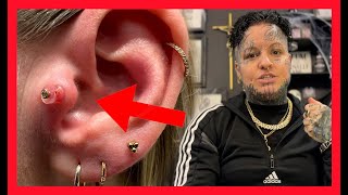 PIERCING BUMP Treatment ⚠️ What is Keloid ⁉️ Everything You Need To Know
