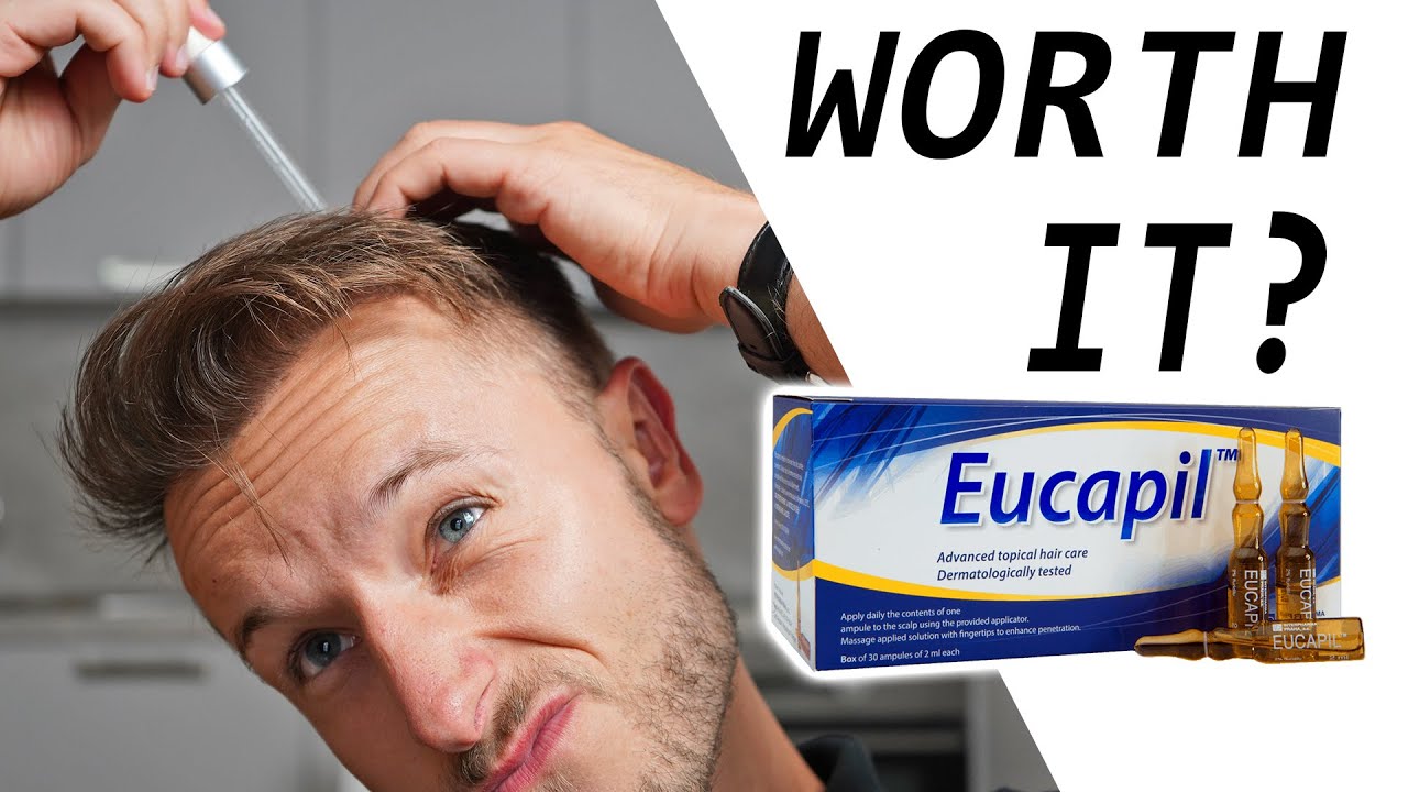 Fluridil - Anti Androgen For Hair Loss! Worth It?
