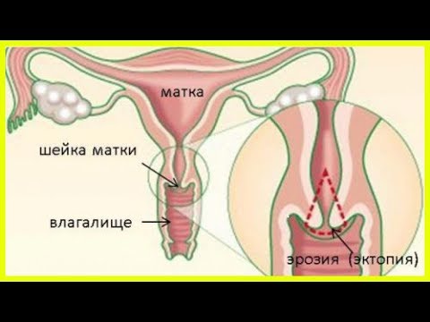 Шарик Внутри Влагалища Шарик Внутри Влагалища