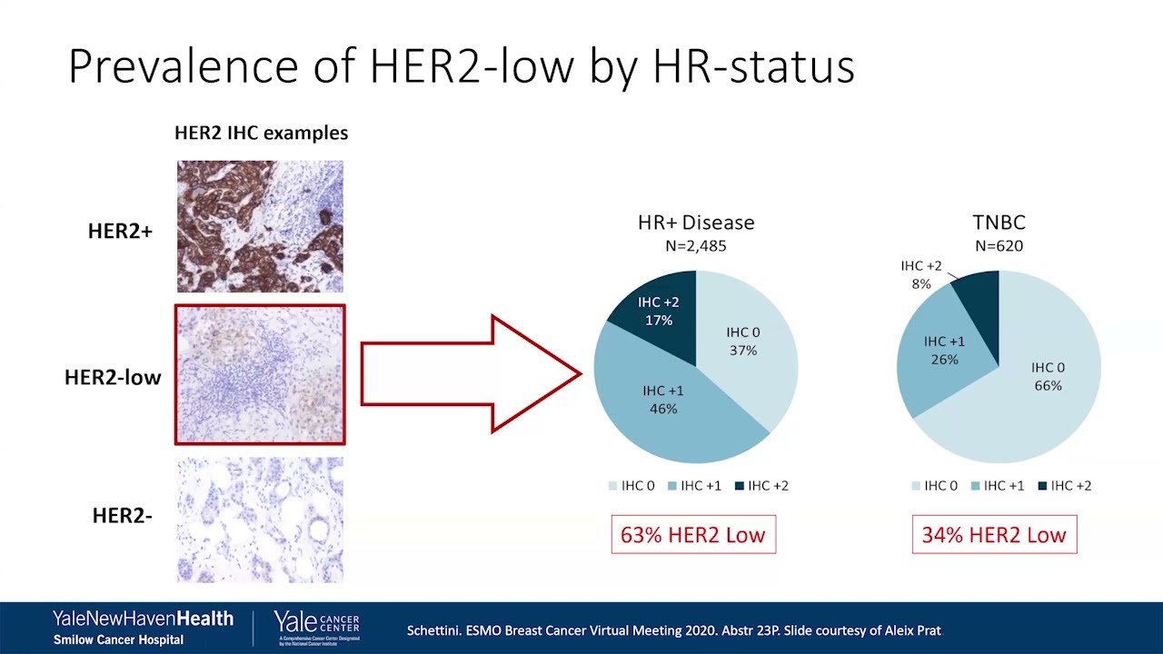 HER2 as a Target in Breast Cancer: How Do We Measure and Act on Personalizing Therapies
