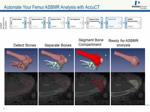 Using microCT to Assess Bone Loss in Preclinical Models
