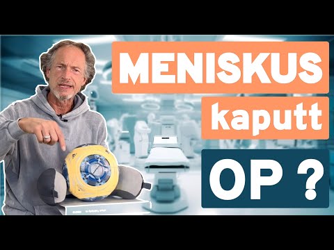 Meniscus in the knee: Surgery or conservative treatment? Advantages and disadvantages at a glance