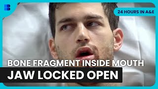 Jaw Locked Open After Random Punch Attack London | 24 Hours in A&E