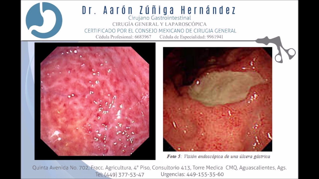 Aarón Zúñiga Hernández-13