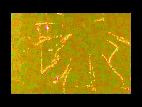 Pro Shoot!!! (Medway,Ma)