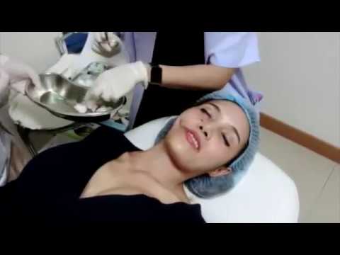 ร้อยไหม หน้าเรียว