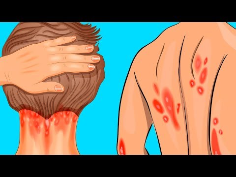 10 Signes qui indiquent une déficience en vitamine D