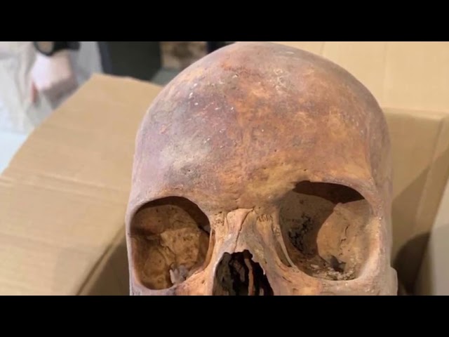 Vídeo relacionado con Antropología dental (Antropología física)