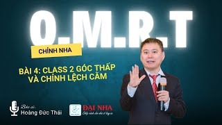 Chỉnh nha OMRT: Bài 4 Ca class II góc thấp và chỉnh lệch cằm