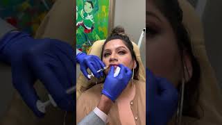 Understanding Lip Filler: What a Denver lip injector physician needs you to know