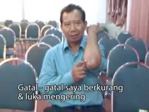 Patogen perempuan populer Bagaimana membuat jahe untuk potensi