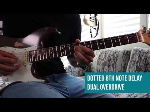 Vi la Luz (See the Light) - Hillsong Worship | Primera Guitarra